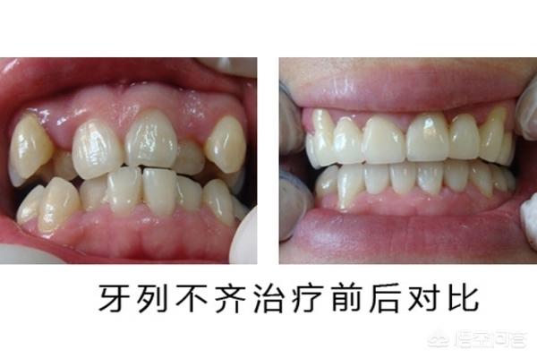 瑞安最新24小时牙医在线咨询方法分析(最方便真实的瑞安有没有24小时牙医方法)